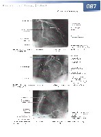 Sobotta  Atlas of Human Anatomy  Trunk, Viscera,Lower Limb Volume2 2006, page 94